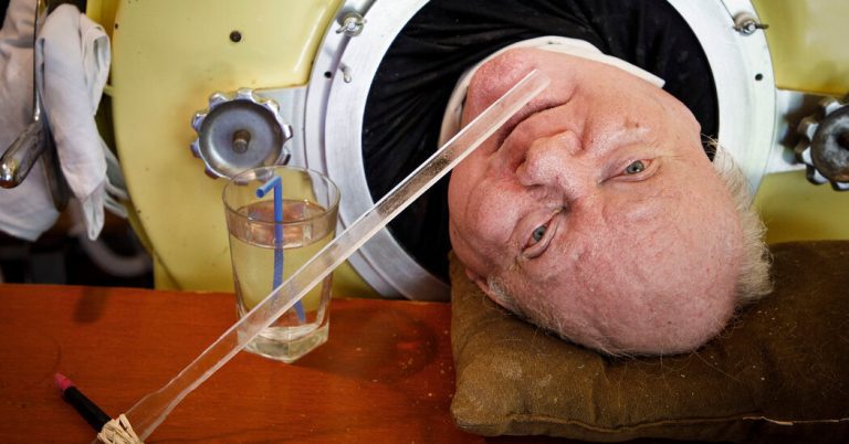 Paul Alexander, polio survivor who lived in iron lung for 70 years, dies aged 78