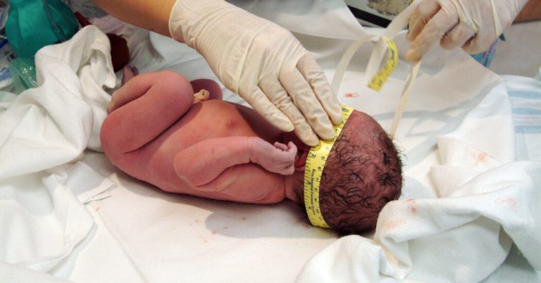 Medical experts alarmed by out-of-hospital C-sections in Florida